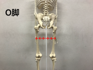 太ももの隙間と骨盤の関係性 大阪のパーソナルトレーニングジムnavis
